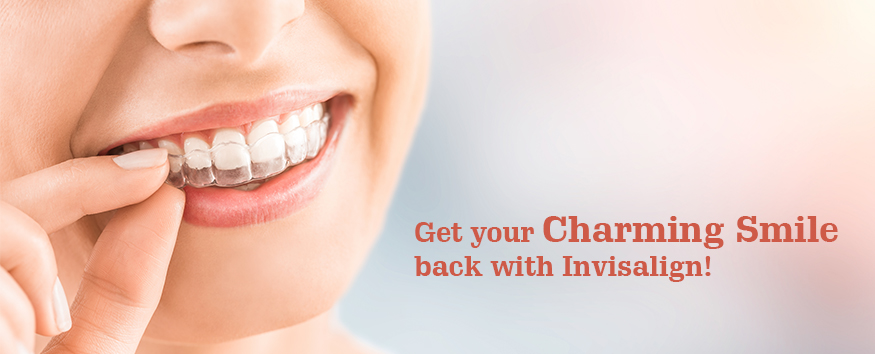 Get-your-charming-smile-back-with-Invisalign-Dental-Sphere-Pune.jpg