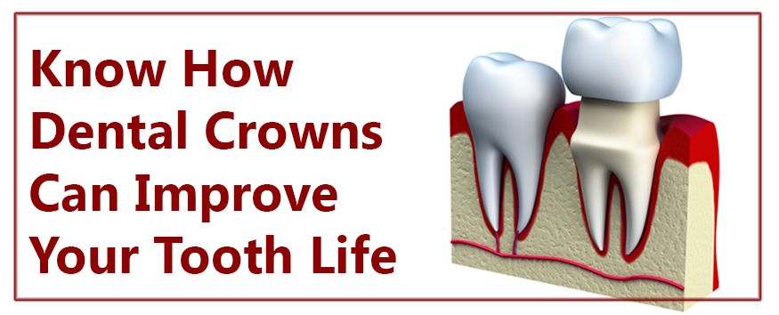 Know How Dental Crowns Can Improve Your Tooth Life - Best Dentist in Pune